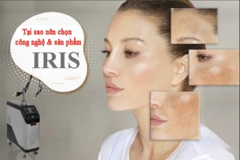 Tại sao nên chọn công nghệ và sản phẩm Iris