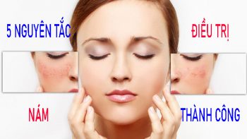 5 Nguyên tắc điều trị nám thành công