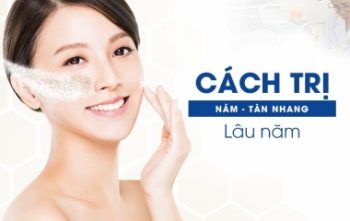 Cách điều trị nám lâu năm chuẩn y khoa